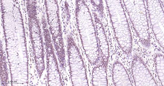 Tar DNA 结合蛋白43即用型免疫组化试剂盒-IHC0429
